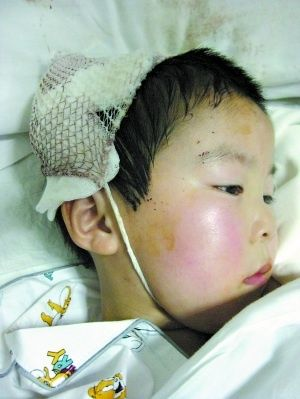 A child receives treatment in a hospital in Taixing of Jiangsu province on Thursday.