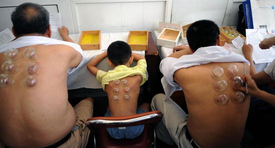 Three people take the cupping treatment before putting on &apos;futie&apos; at a hospital in Tianjin, north China, on the first day of &apos;toufu&apos; this year July 19, 2010. [Xinhua]