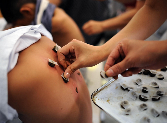 A patient gets medical plasters sticked on his back at Shenyang Chinese Medicine Hospital on the first day of &apos;toufu&apos; this year in Shenyang, capital of northeast China&apos;s Liaoning province on July 19, 2010. [Xinhua]