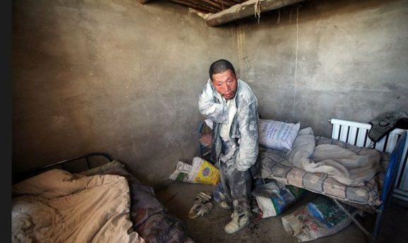 A mentally ill worker rests in a room at the Jiaersi Green Construction Material Chemical Factory in Toksun county, Northwest China's Xinjiang Uygur autonomous region. [Photo/Xinjiang Metropolis News] 