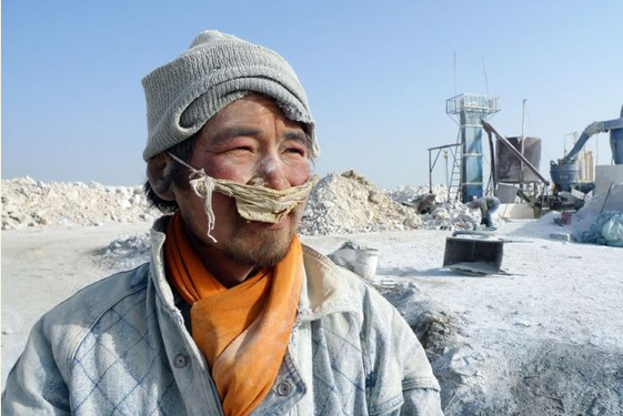 A mentally ill worker looks on at a construction site at the Jiaersi Green Construction Material Chemical Factory in Toksun county, Northwest China's Xinjiang Uygur autonomous region. [Photo/Xinjiang Metropolis News]