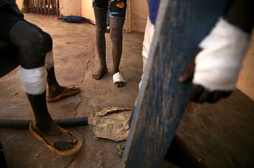 几内亚蠕虫肆虐非洲 无数儿童丧失行动能力[组