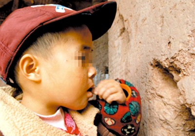 五龄童患怪病吃泥吃穿一堵墙