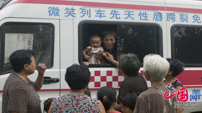 重塑命運綻放微笑 '微笑列車'救助唇腭裂兒童[組圖]