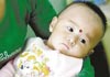 婴幼儿肾结石形成主因以及应对措施