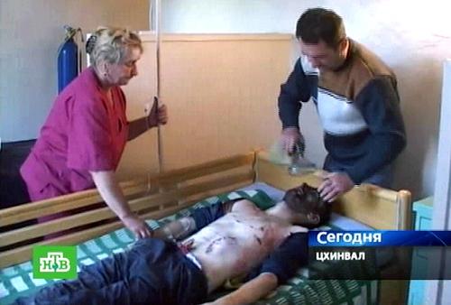  俄罗斯一家电视台10月3日拍摄的画面显示，一名在南奥塞梯首府茨欣瓦利的爆炸事件中受伤的男子在接受治疗。俄罗斯派驻南奥塞梯首府茨欣瓦利的维和部队总部附近当天发生汽车爆炸事件，造成7人死亡、3人重伤，死者中有军人也有平民。