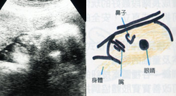 首页 优讯 母婴 怀孕分娩