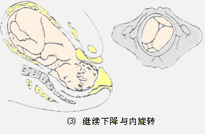 揭秘胎儿如何经过产道(组图)