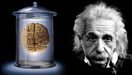 美国研究证明爱因斯坦大脑形状异于常人