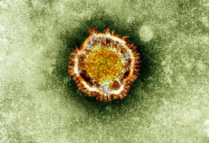 沙特：新型冠狀病毒死亡人數升至24人