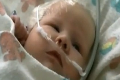 美国女婴患脑动脉瘤 “超级胶水”黏合创口