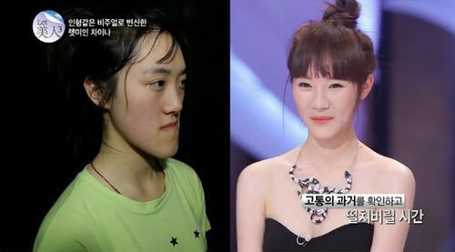 中国<em>丑女</em>上韩整容<em>节目变美女</em> 父母:认不出(图)