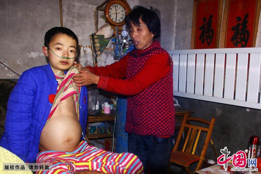 耿得水的母亲曹诗燕在察看孩子因积水而隆起的肚子。15岁的耿得水身高不足1.4米，体重36斤，看上去像个八、九岁的孩子。中国网图片库 刘明祥/摄