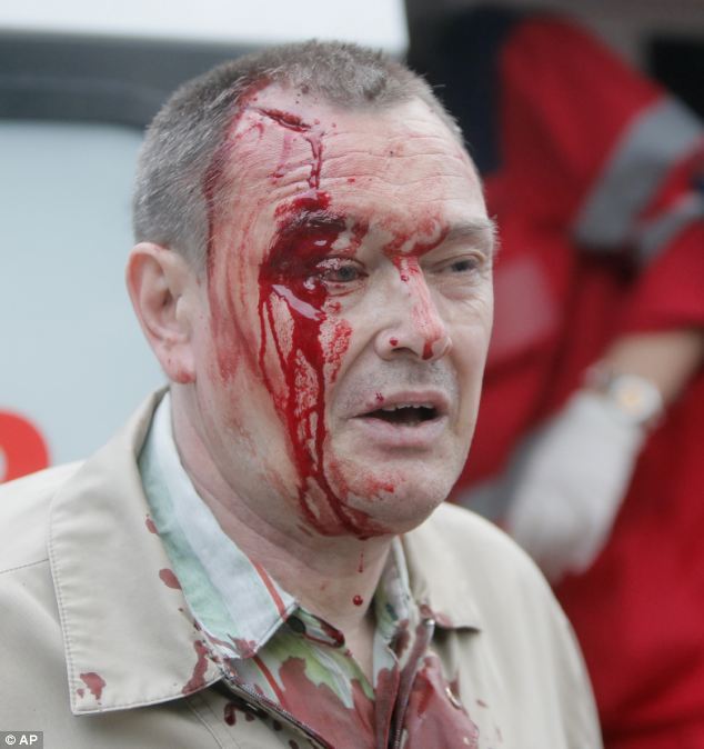 4月28日，上千名蒙面亲俄者手持棍棒与钢筋袭击了顿涅茨克的一个呼吁民族团结的亲乌者集会，当时防暴警察试图阻止这些亲俄袭击者，但仍有站在路旁的数十名亲乌者被袭击受伤。