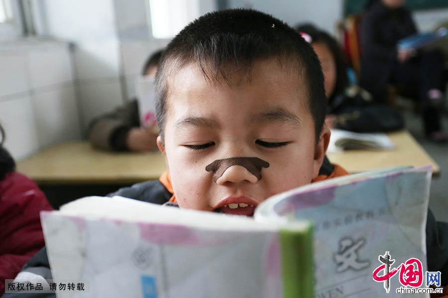 教室里，由于天气寒冷，一名小男孩鼻子上贴上了保暖防湿的贴片，用来驱寒保暖