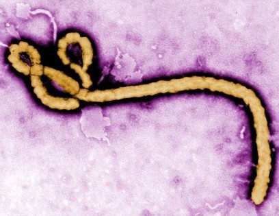 普通感冒到出血不止：感染埃博拉会怎样