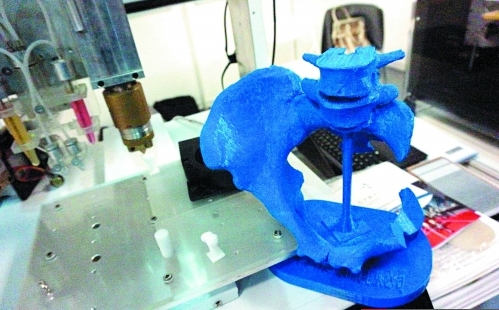 医疗3D打印技术造福老区患者