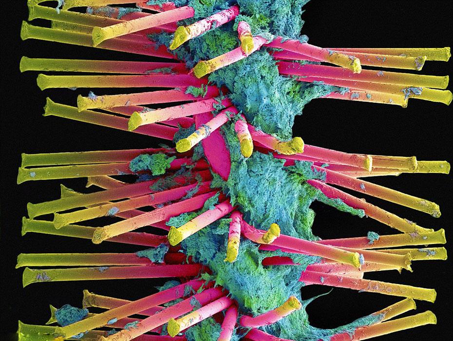 实拍电子显微镜下毛骨悚然的牙齿细菌[组图]