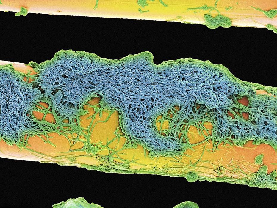 实拍电子显微镜下毛骨悚然的牙齿细菌[组图]