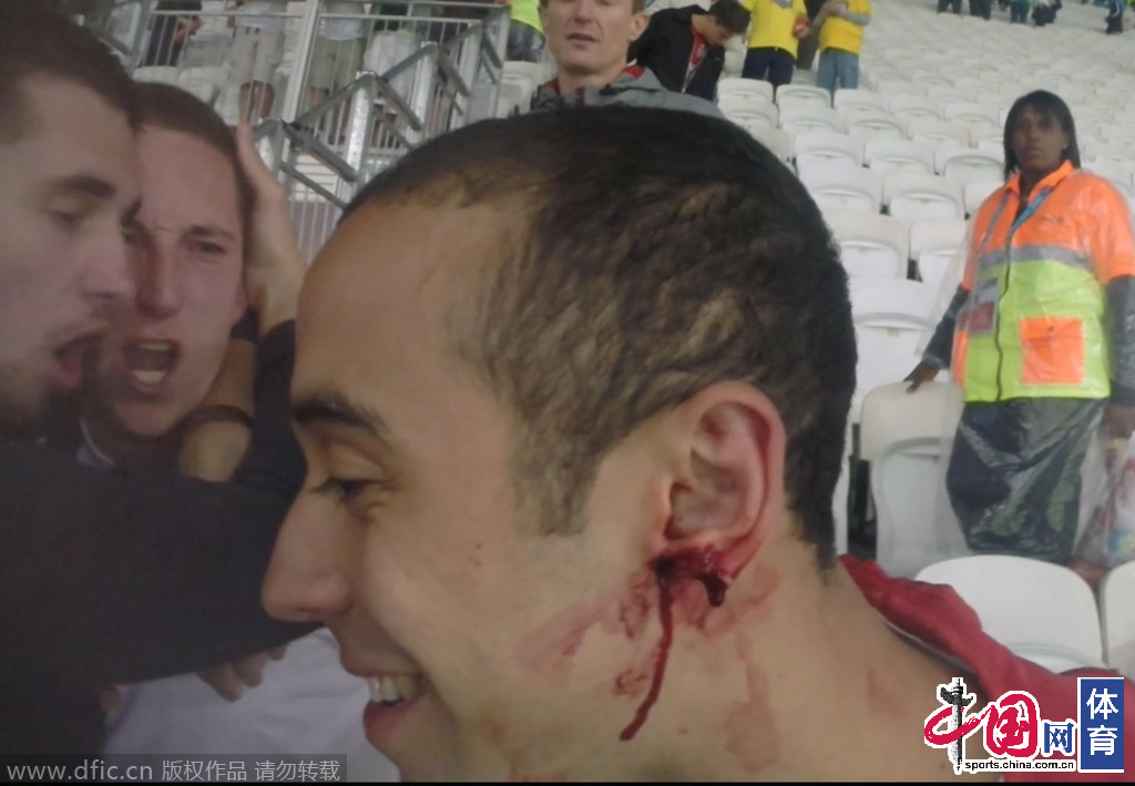 盘点赛场那些肾腺上素飙升的血腥暴力疯狂瞬间