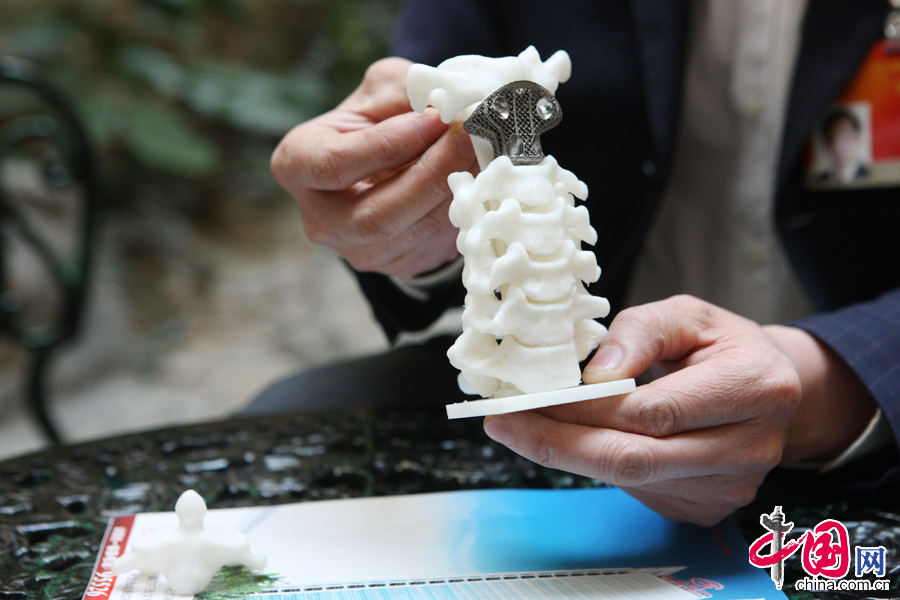 劉忠軍代表向記者介紹3D列印金屬內植物在人體骨骼填充中起到良好效果。 中國網董寧攝影