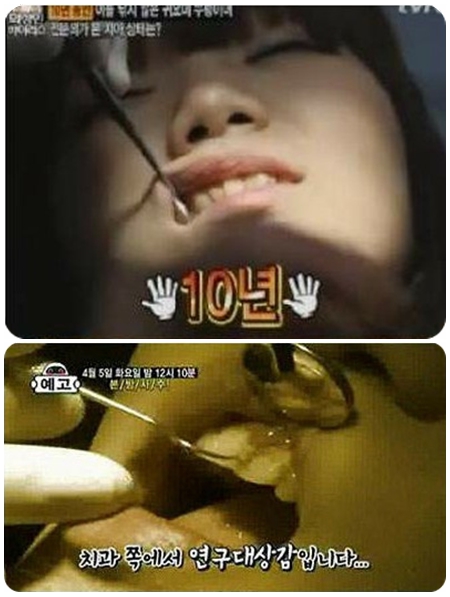 深扒日韩综艺里的奇葩 <em>女美容师</em>10年不刷牙_娱