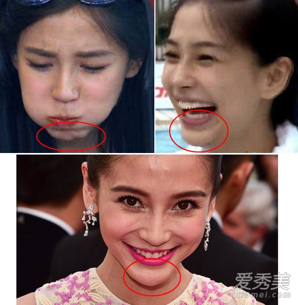 baby下巴 小s鼻子 假体暴露也不承认整容(图)