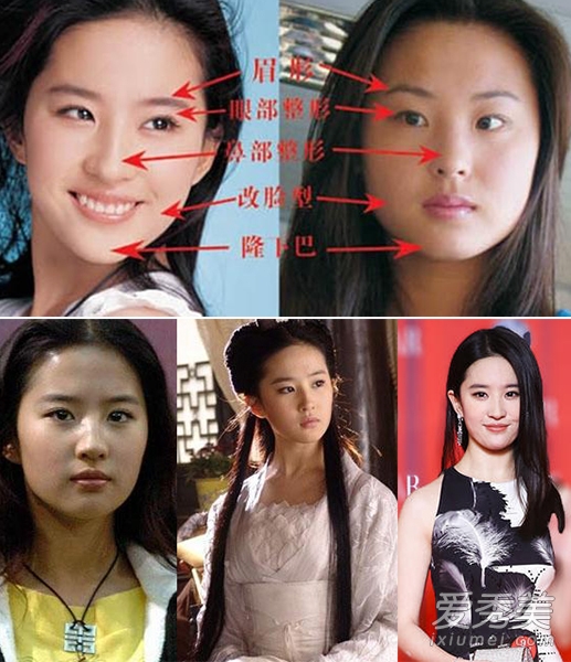 假脸明星:柳岩承认整容 baby刘亦菲被整容(图)