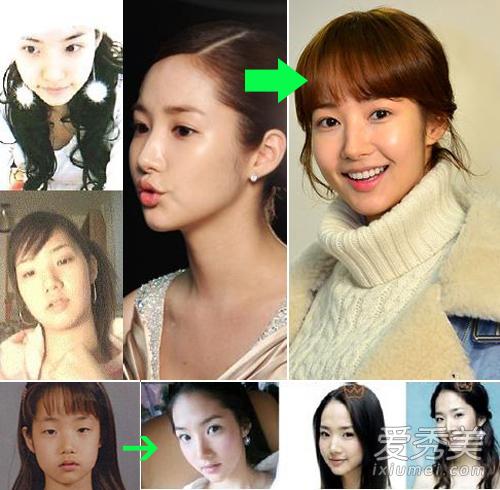 韩国"整容最厉害"女星:朴敏英9年3次"变脸"