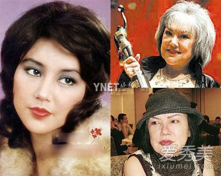 原标题:网曝沈梦辰整容前旧照村姑变女神差距大 邵音音年轻时被称为是