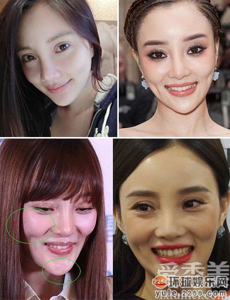 女明星整容前后照片对比 天生丽质反整残!