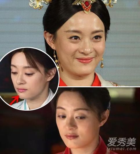 孙俪下巴痣巩俐媒婆痣 女星脸上"美痣"有啥寓意