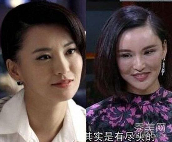 郑爽姚芊羽莫小棋似"毁容" 10大整容失败案例