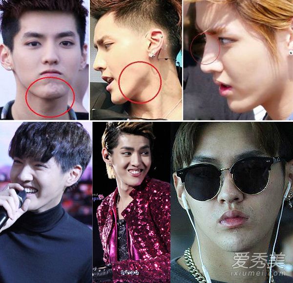 揭秘中韩"欧巴"整容真假脸 胡歌霍建华吴亦凡躺枪