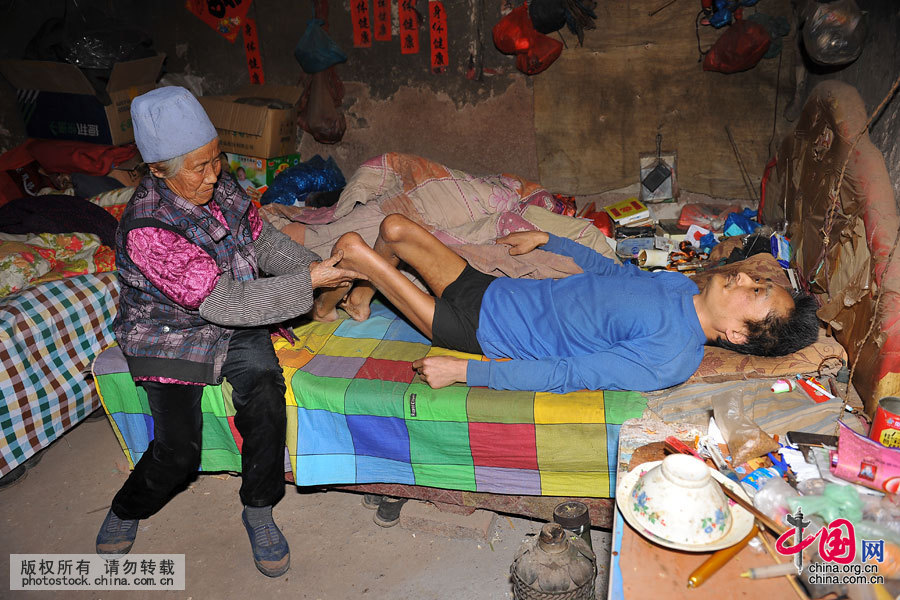 2016年3月23日，在山東省日照市莒縣劉官莊鎮大官莊村，今年77歲的老人夏培英（左）正在為兒子王恒亮（右）進行按摩，多年臥床不起，他的腿上肌肉萎縮嚴重。中國網圖片庫 劉明照 攝