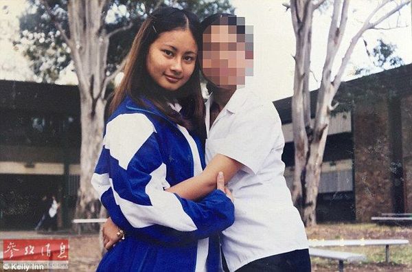 女子被猥亵9年患拔毛癖:只能跳钢管舞