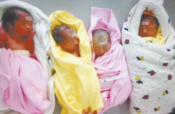 伴随著婴儿的啼哭声,来自日照的27岁产妇李娟生下了双龙双凤四胞胎,这