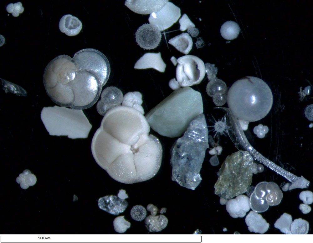 在“決心”號顯微鏡下拍攝的有孔蟲（3月14日攝）。
