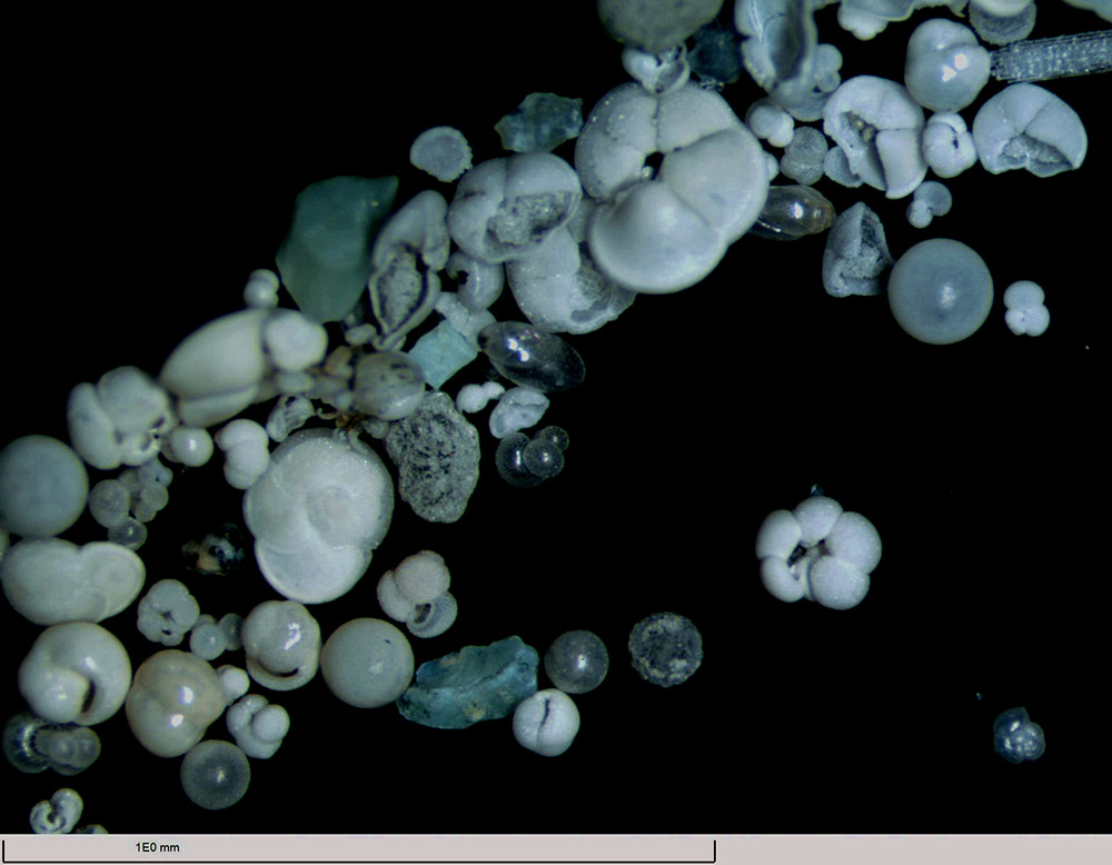 在“决心”号显微镜下拍摄的有孔虫（3月14日摄）。