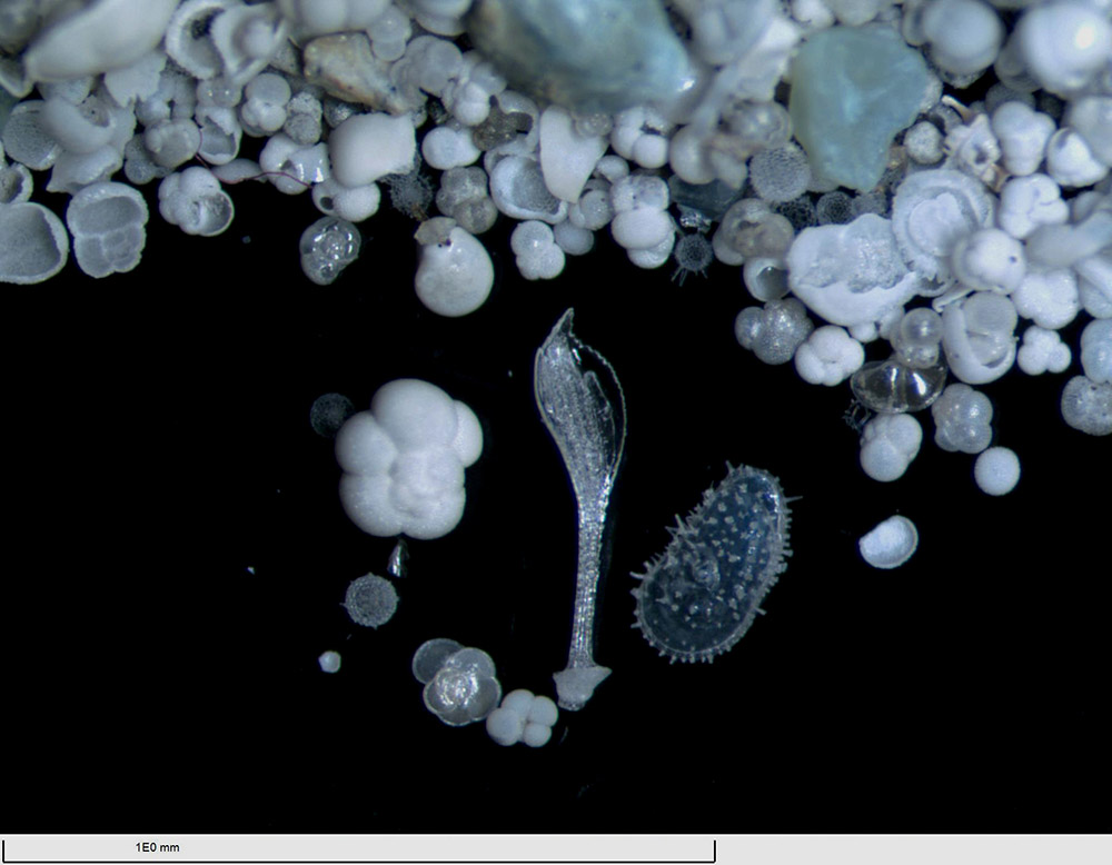在“决心”号显微镜下拍摄的有孔虫（3月14日摄）。