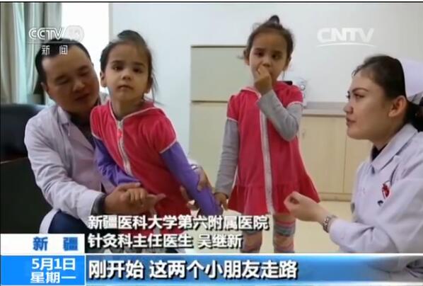 到中國接受治療的腦癱雙胞胎