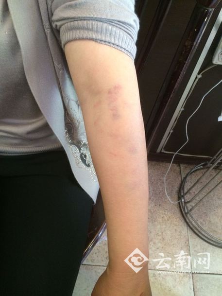 昆明一小区因停车堵消防通道连打两架 女司机称遭到6人围殴