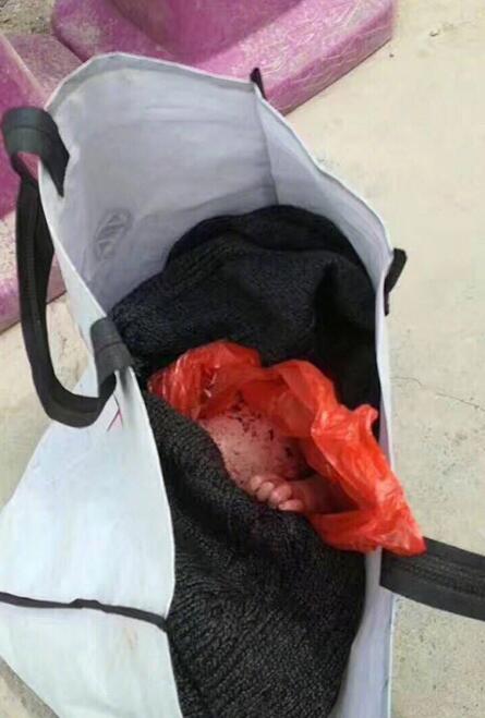 新生儿被装塑料袋遗弃在工地门口( 02 / 4 )