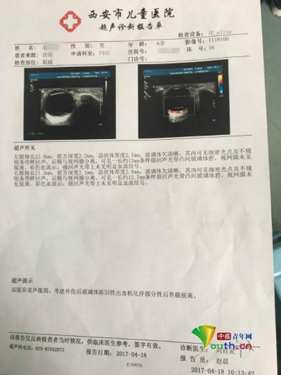 胃穿孔住院报告单图片图片