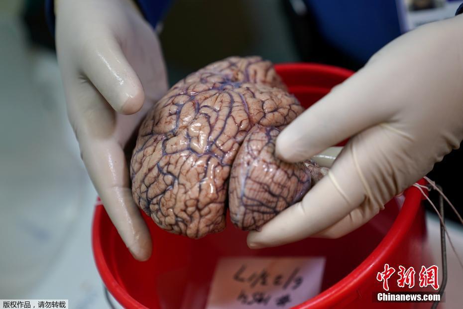 窺探美國紐約大腦銀行 冷凍人腦用電鋸切片保存