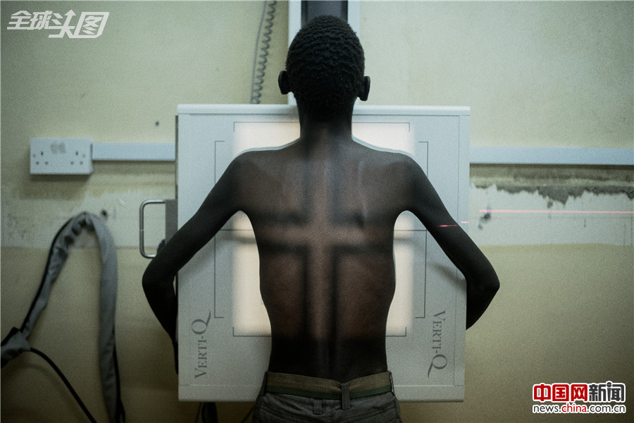非洲：艾滋病正在改变的面貌