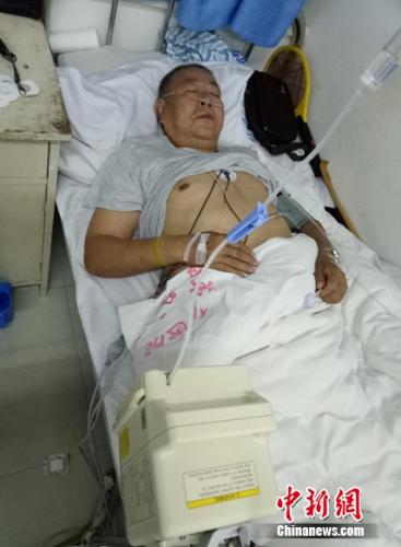 中日专家会诊日遗化武受害者 有人是重症病房常客 中日专家会诊日遗化武受害者 有人是重症病房常客