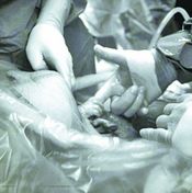 مولودة تمسك يد الطبيب وهي تخرج من رحم أمها في أمريكا 
