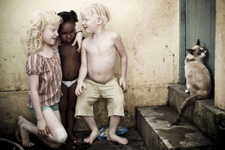 Le 25 août 2009, Albino siblings Esthefany Caroline (à gauche) et Kauan Fernandes (à droite) samusent avec leur cousine Taina (au centre), devant leur maison située dans le bidonville V9 d Olinda, au Brésil.