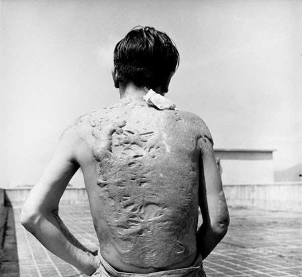 Photos d&apos;archives : Hiroshima après la bombe atomique